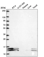 Western blot analysis in human cell line RT-4, human cell line U-251 MG, human plasma, human liver tissue and human tonsil tissue.