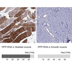 Anti-PPP1R3A Antibody