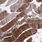 Immunohistochemical staining of human skeletal muscle shows high expression.
