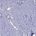 Immunohistochemical staining of human smooth muscle shows low expression as expected.