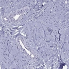 Immunohistochemical staining of human smooth muscle shows low expression as expected.