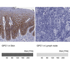 Anti-GPC1 Antibody