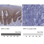 Anti-GPC1 Antibody