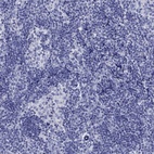 Anti-GPC1 Antibody