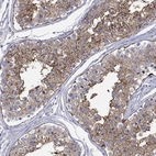 Immunohistochemical staining of human testis shows strong membranous/ cytoplasmic positivity in cells in seminiferous ducts.