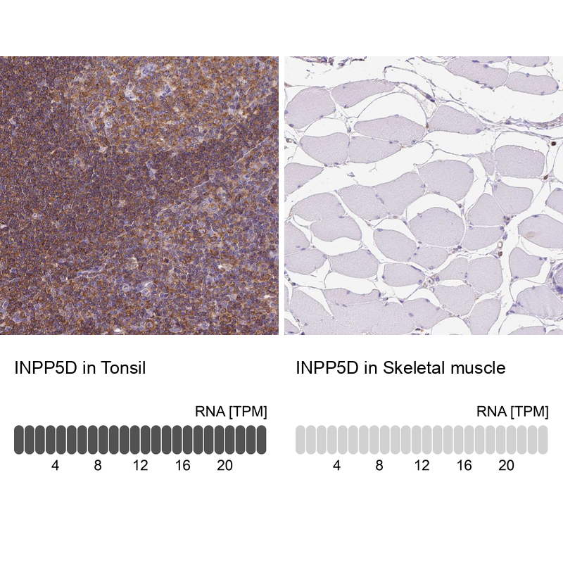 Anti-INPP5D Antibody