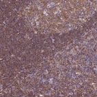 Immunohistochemical staining of human tonsil shows strong cytoplasmic positivity in non-germinal center cells.