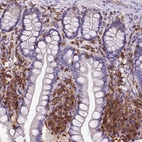 Immunohistochemical staining of human small intestine shows strong cytoplasmic positivity in lymphoid cells.