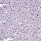 Immunohistochemical staining of human liver shows no positivity in hepatocytes as expected.