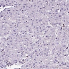 Immunohistochemical staining of human liver shows no positivity in hepatocytes as expected.