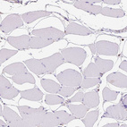 Immunohistochemical staining of human skeletal muscle shows no positivity in myocytes as expected.