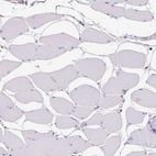 Immunohistochemical staining of human skeletal muscle shows no positivity in myocytes as expected.