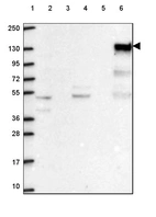 Lane 1: Marker [kDa] 250, 130, 95, 72, 55, 36, 28, 17, 10_br/_Lane 2: Human cell line RT-4_br/_Lane 3: Human cell line U-251 MG_br/_Lane 4: Human plasma_br/_Lane 5: Human Liver tissue_br/_Lane 6: Human Tonsil tissue