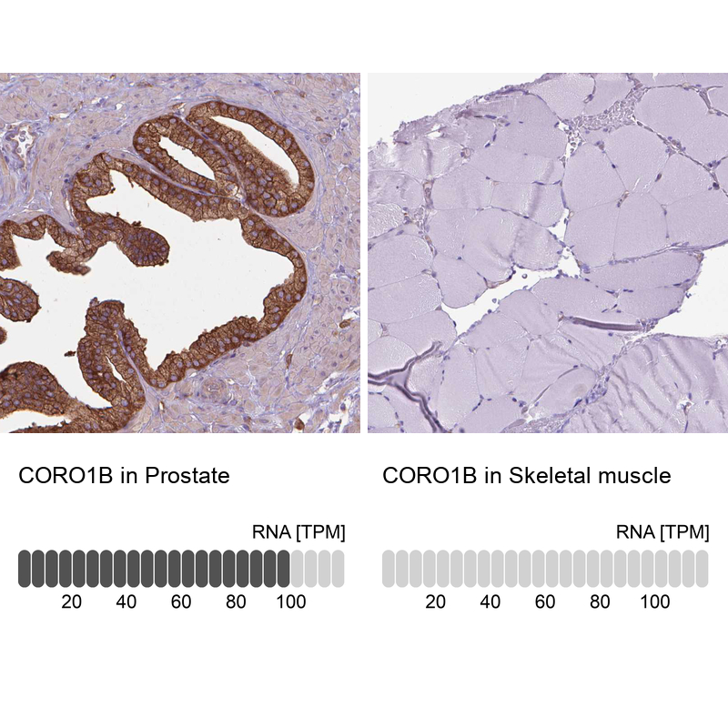 Anti-CORO1B Antibody