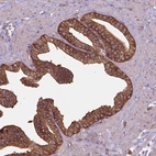 Immunohistochemical staining of human Prostate shows strong cytoplasmic positivity in glandular cells.