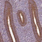 Immunohistochemical staining of human Endometrium shows strong cytoplasmic positivity in glandular cells.