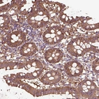 Immunohistochemical staining of human Colon shows moderate cytoplasmic positivity in glandular cells.