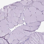 Immunohistochemical staining of human Skeletal muscle shows no positivity in myocytes.