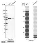 Western blot analysis in human cell lines MCF-7 and U-251MG using Anti-CORO1B antibody. Corresponding CORO1B RNA-seq data are presented for the same cell lines. Loading control: Anti-PPIB.