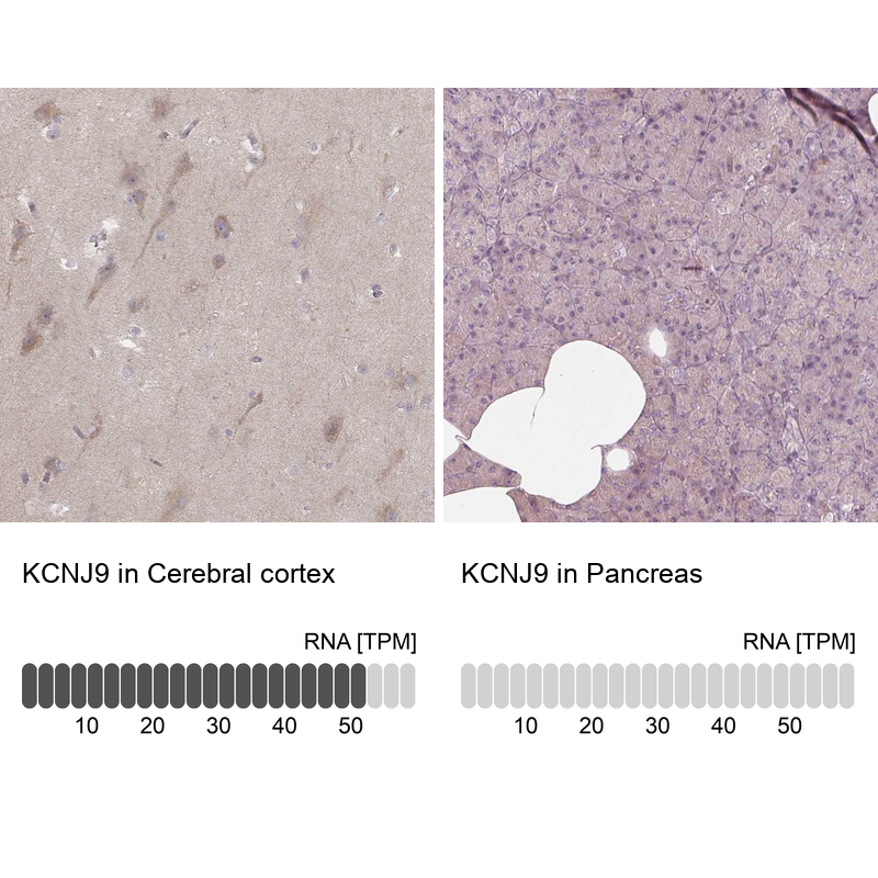 Anti-KCNJ9 Antibody