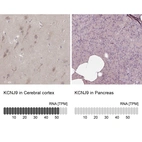 Anti-KCNJ9 Antibody