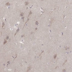 Immunohistochemical staining of human cerebral cortex shows high expression.