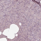 Immunohistochemical staining of human pancreas shows low expression as expected.