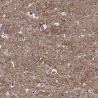 Immunohistochemical staining of human hippocampus shows strong cytoplasmic positivity in neuropil.