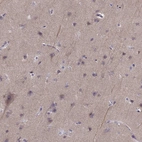 Immunohistochemical staining of human cerebral cortex shows weak cytoplasmic positivity in neuropil.