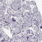 Immunohistochemical staining of human placenta shows no positivity in trophoblastic cells as expected.