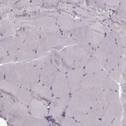 Immunohistochemical staining of human skeletal muscle shows no positivity in myocytes as expected.