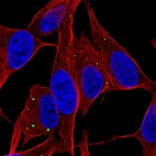 Anti-SERTM1 Antibody