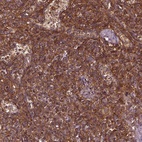 Anti-RASSF5 Antibody