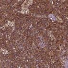 Anti-RASSF5 Antibody