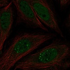 Anti-MKNK2 Antibody