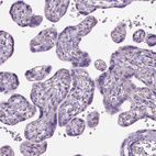 Immunohistochemical staining of human placenta shows no cytoplasmic positivity in trophoblastic cells as expected.