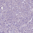 Immunohistochemical staining of human pancreas shows no cytoplasmic positivity in exocrine glandular cells as expected.