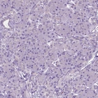 Immunohistochemical staining of human pancreas shows no cytoplasmic positivity in exocrine glandular cells as expected.