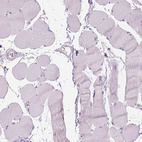 Immunohistochemical staining of human skeletal muscle shows no cytoplasmic positivity in myocytes as expected.