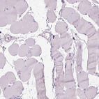 Immunohistochemical staining of human skeletal muscle shows no cytoplasmic positivity in myocytes as expected.