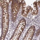 Anti-ERBB3 Antibody