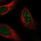 Anti-UCK1 Antibody