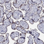 Anti-TFPI2 Antibody