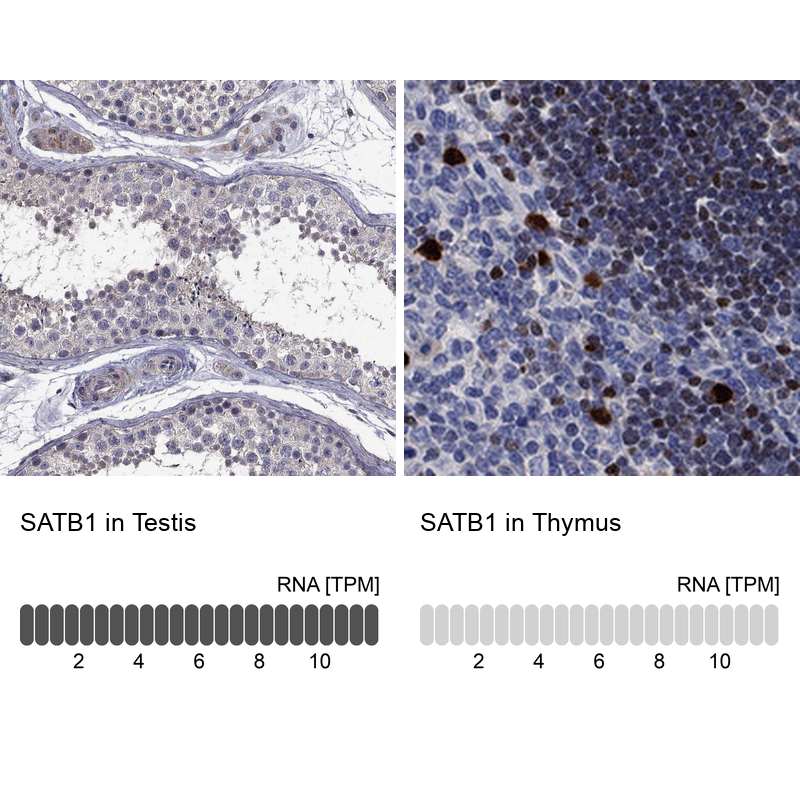 Anti-SATB1 Antibody