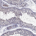 Immunohistochemical staining of human testis shows high expression.
