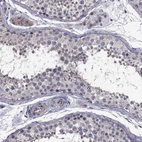 Immunohistochemical staining of human testis shows high expression.