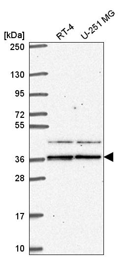 Anti-SPRY1 Antibody