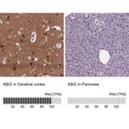 Anti-ABI2 Antibody