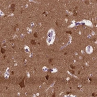 Immunohistochemical staining of human cerebral cortex shows high expression.