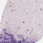 Anti-SCGN Antibody